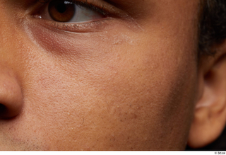 HD Face skin Javion Norris cheek eye face skin pores…